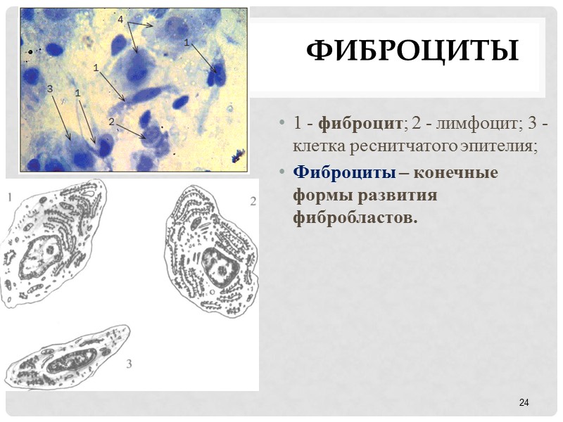 Фиброциты  1 - фиброцит; 2 - лимфоцит; 3 - клетка реснитчатого эпителия; 